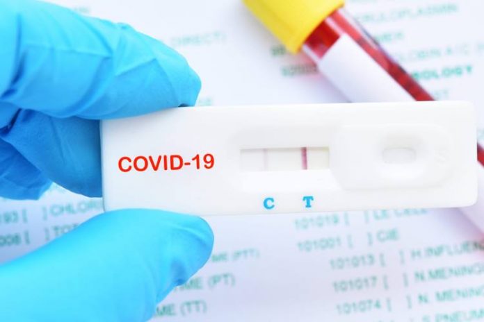 Rapid-Test-Covid19