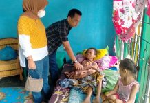Tubuh Mengecil, Warga Sergai Harapkan Bantuan Pemkab